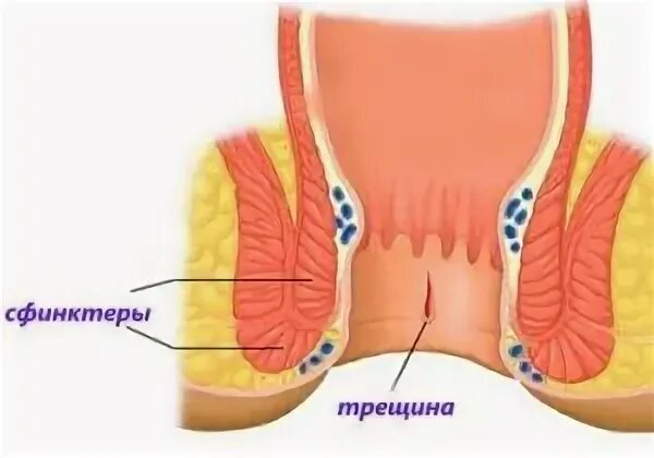 Картинки ВНУТРИ ЗАДНЕГО ПРОХОДА