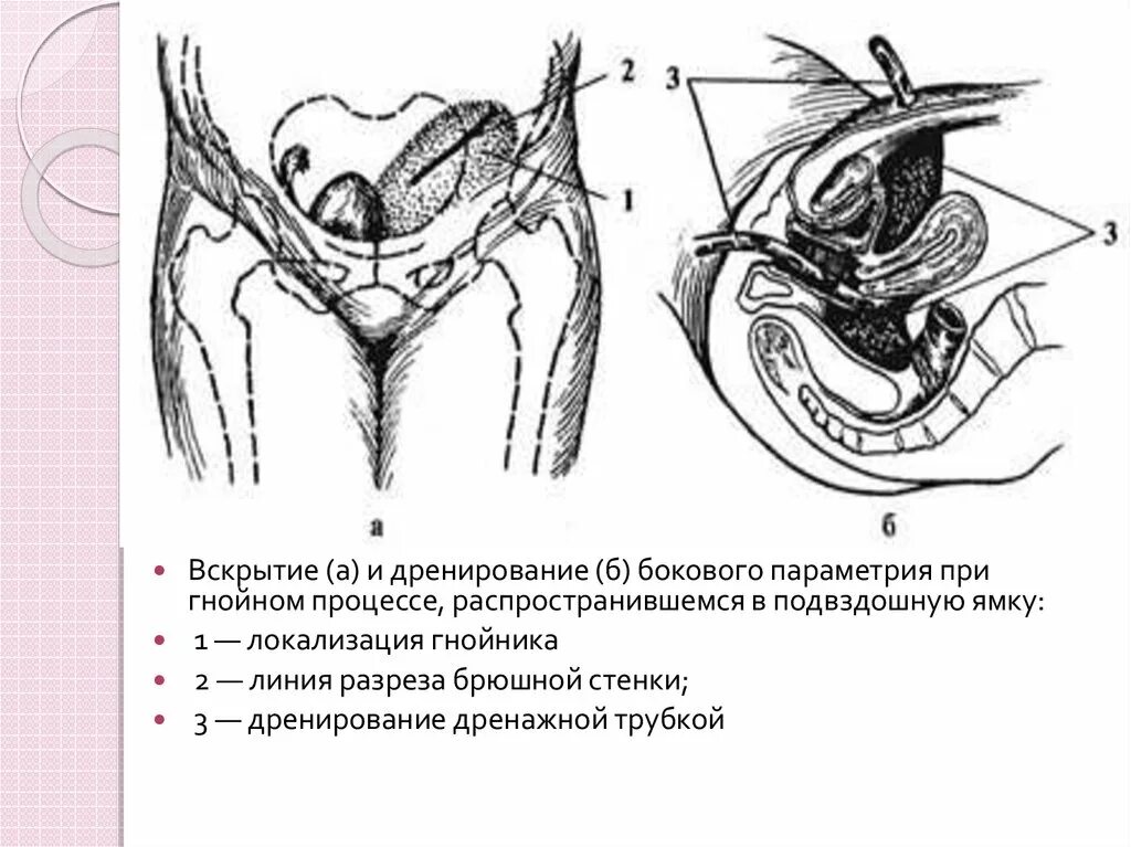 Параметрий это