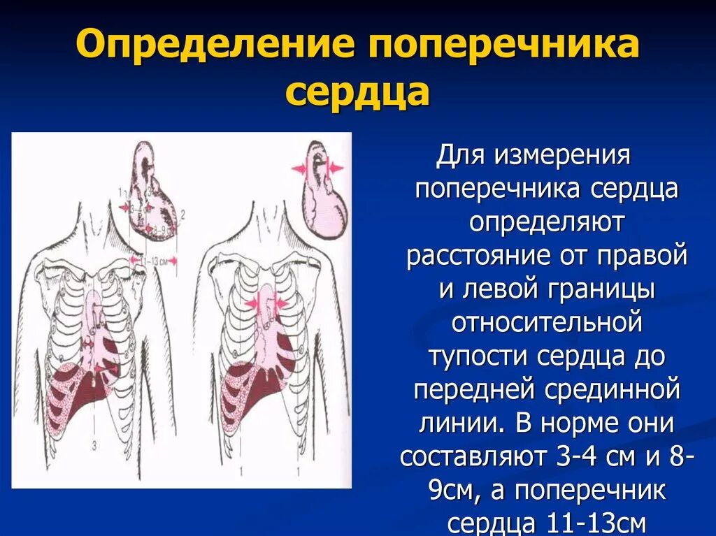 Поперечник относительной тупости сердца в норме. Определение поперечника сердца. Размеры поперечника сердца. Длинник и поперечник сердца.