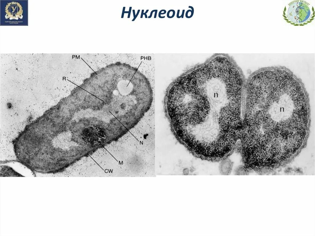 Кольцевой нуклеоид. Нуклеоид бактерий строение. Нуклеоид микрофотография. Нуклеоид прокариот представляет собой:. Нуклеоид строение.