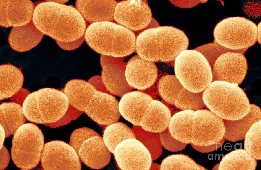 Streptococcus thermophilus