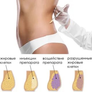 Уколы для похудения форум