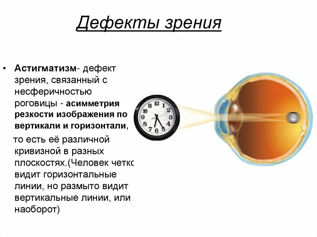 Дефекты зрения ответы