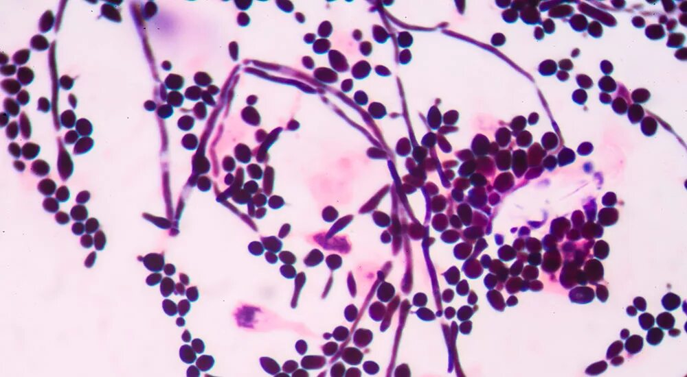 Candida albicans псевдомицелий. Споры кандида. Грибок кандида псевдомицелий. Мицелий и псевдомицелий. Споры кандида.