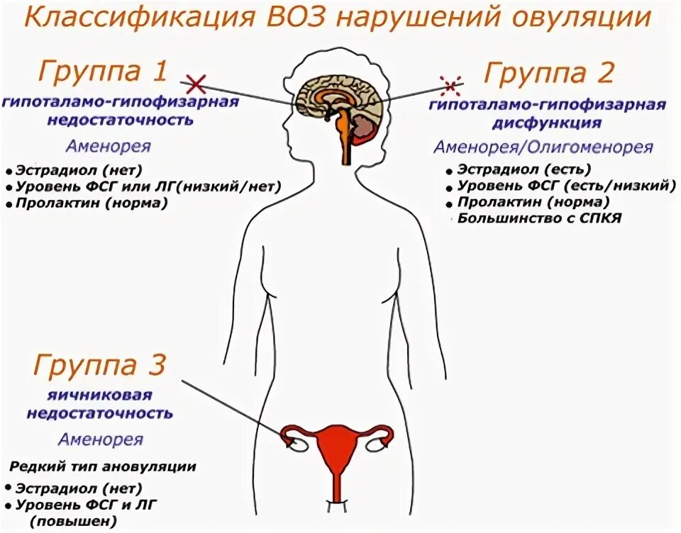 Нарушение овуляции