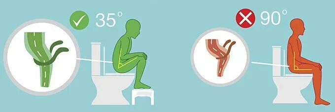 Правильная поза для туалета. Правильная поза для дефекации. Правильная поза для туалета по большому. Поза для опорожнения.