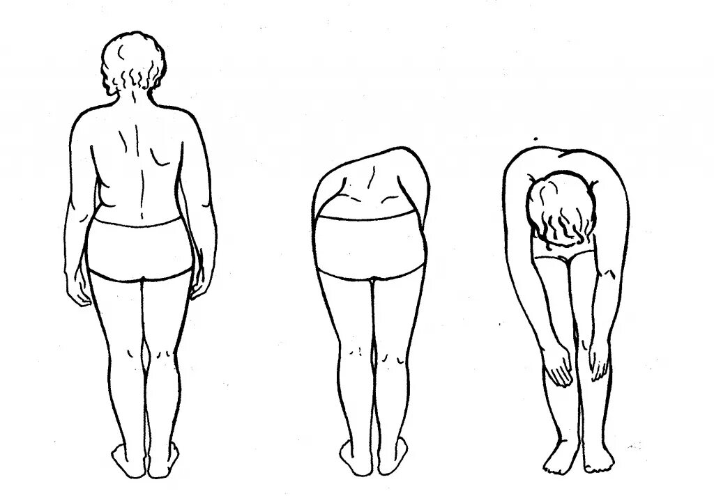 Тест поясница. Сколиоз при наклоне вперед. Сколиоз торсия. Сколиоз тест Адамса. Соматоскопия осанки.