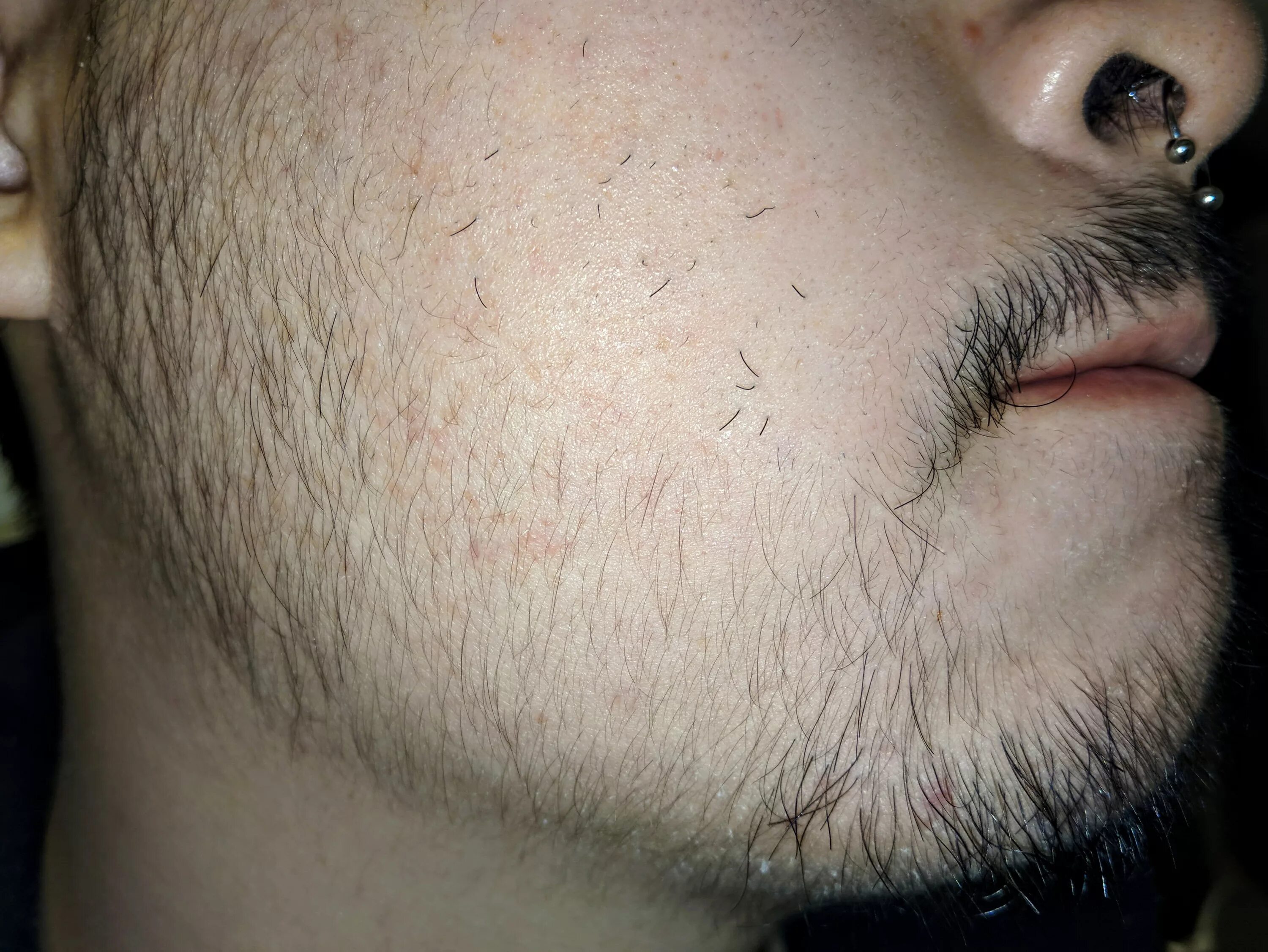 Рост волос на лице у мужчин. Minoxidil для бороды. Волосы на лице у мужчин. Волосики на лице у мужчин. Миноксидил для волос для мужчин для бороды.