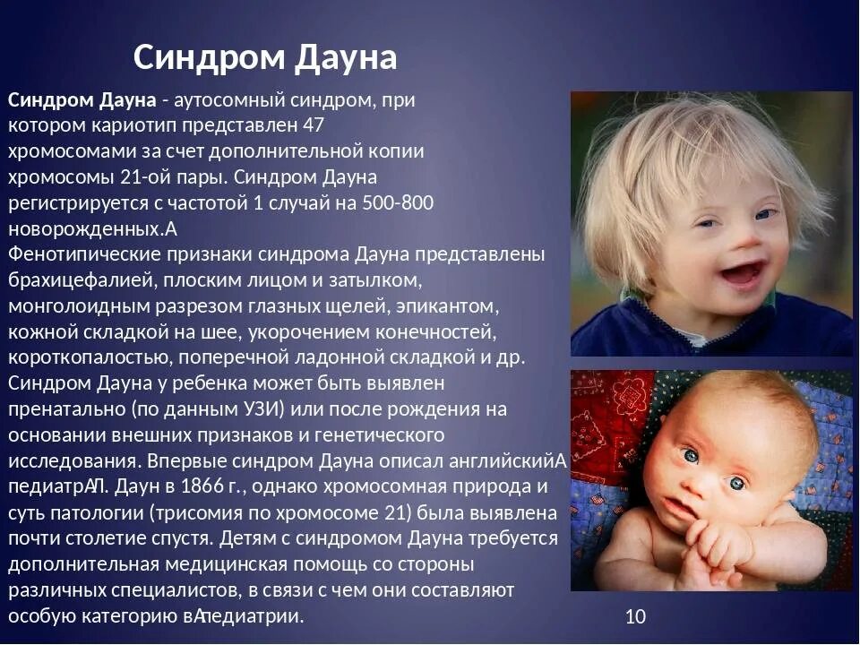 Как определить синдром. Синдром дауна характеристика. генетические заболевания дауна. болезнь дауна характеристика.