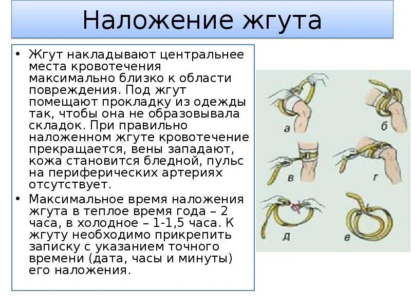 Максимальное время жгута на конечности. Правила использования жгута. наложение жгута при кровотечениях. при правильном наложении жгута. правильное галожентя жгута.