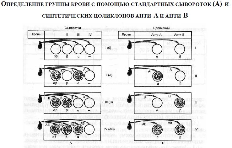 Определение группы крови и резус фактора с помощью цоликлонов. Определение группы крови по цоликлонам алгоритм. Метод определения группы крови цоликлонами. Схема определения группы крови с помощью цоликлонов. Алгоритм группы крови и резус фактора