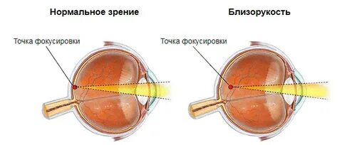 Почему глаз видит точку