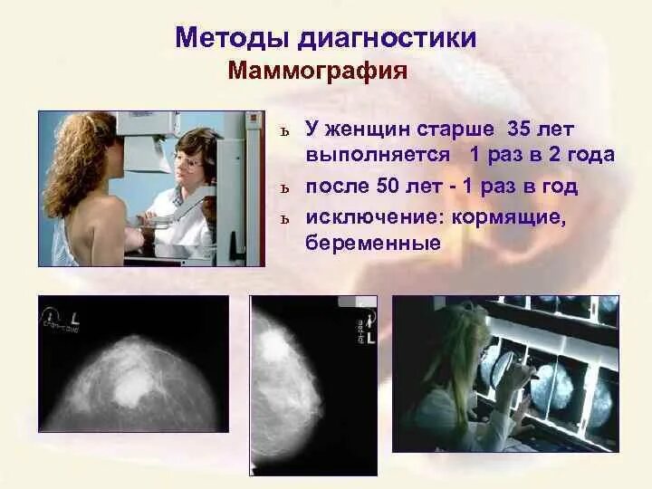 Маммография. Методика проведения маммографии. Маммография женщинам. Маммография молочных желез. Маммография периодичность