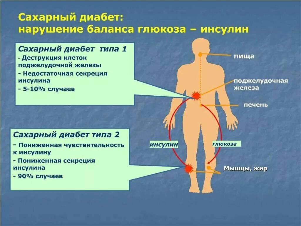 Сахар повышает температуру. Сахарный диабет. Диабет презентация. Сахарный диабет презентация. Сахарный диабет эндокринное заболевание.