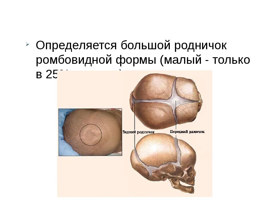 Большой Родничок. Форма большого родничка у новорожденного. Возраст закрытия большого родничка. Сроки закрытия родничков у детей.