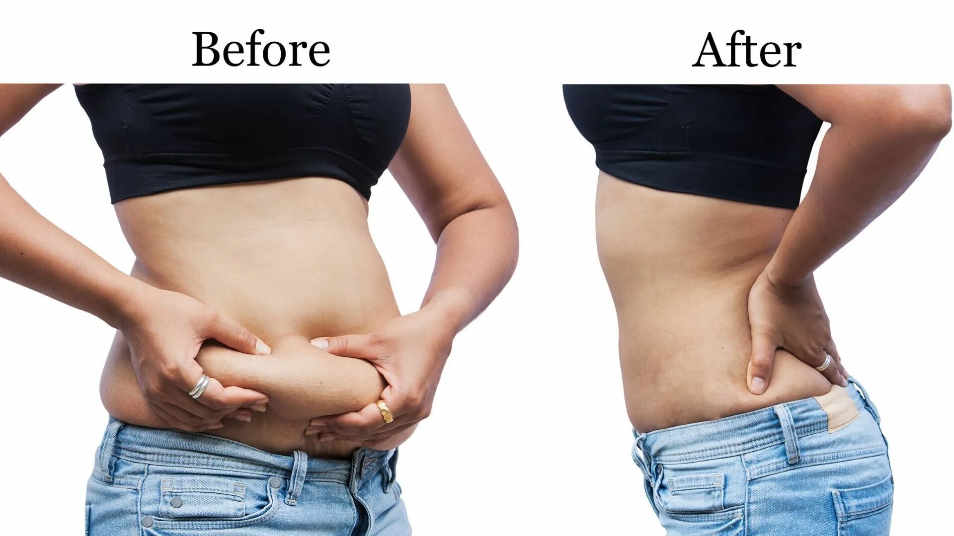Похудение живота до и после фото. Weight lose before after belly fat.