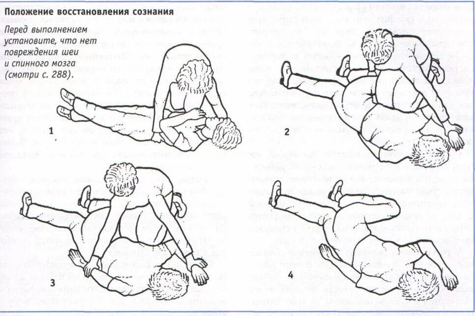 Помощь при сотрясении головного. Оказание помощи при сотрясении мозга. Оказание первой помощи при сотрясении головного мозга. При коме пострадавшего уложить. Положение при сотрясении головного мозга.