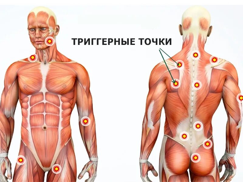 Миофасциальный массаж тела это. Миофасциальный массаж триггерных точек. Триггеры мышц спины. Триггеры в мышцах. Триггерные точки трапеции.