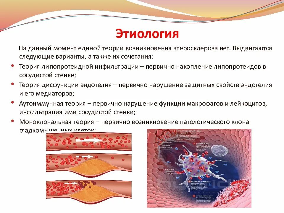 Атеросклероз презентация. Атеросклероз сосудов презентация. Причины появления атеросклероза. Презентация атеросклероз терапия. Атеросклероз что это за болезнь простыми словами