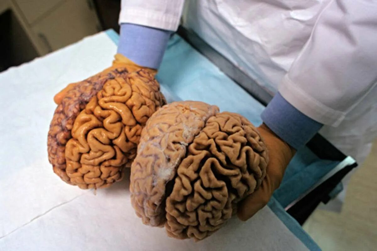 Последний мозг. Мозг человека в реальной жизни. Настоящий человеческий мозг.