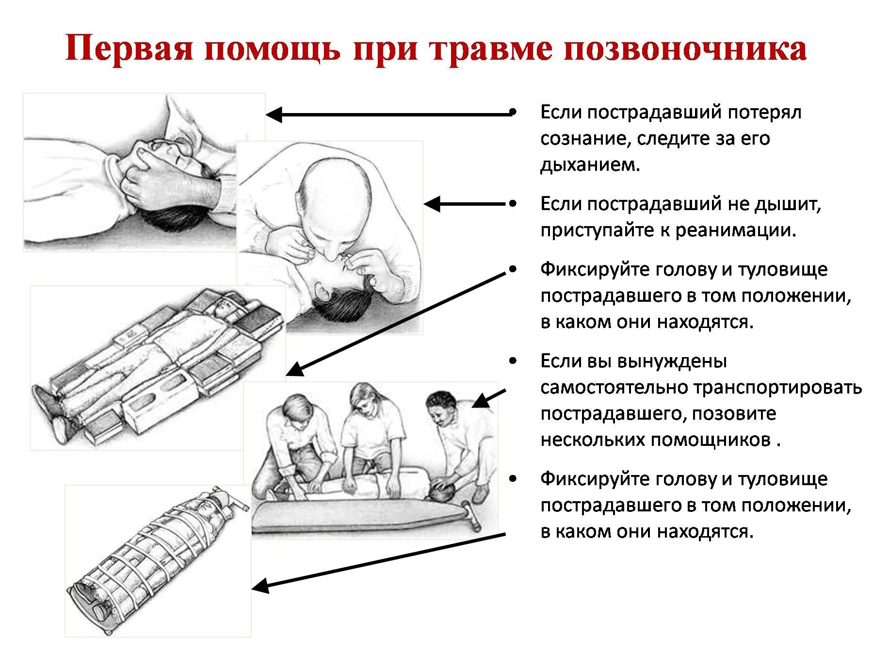 Медицинская помощь при травмах головы. Порядок оказания первой помощи при повреждениях позвоночника. Первая помощь при повреждении позвоночника. Алгоритм оказания первой помощи при повреждениях позвоночника. Алгоритм действий при повреждении позвоночника.