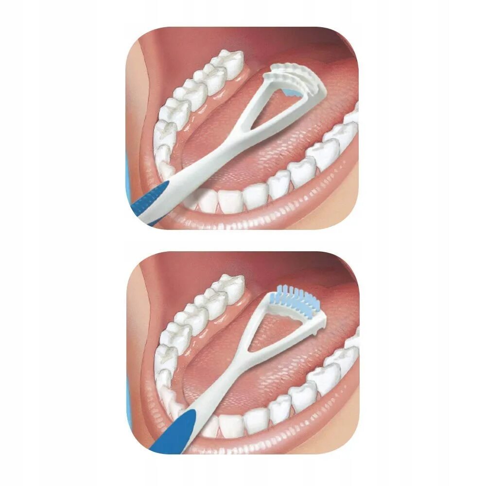 После чистки языка. Щетка для языка Gum. Скребок для языка. Скребки для очистки языка. Предмет для чистки языка.
