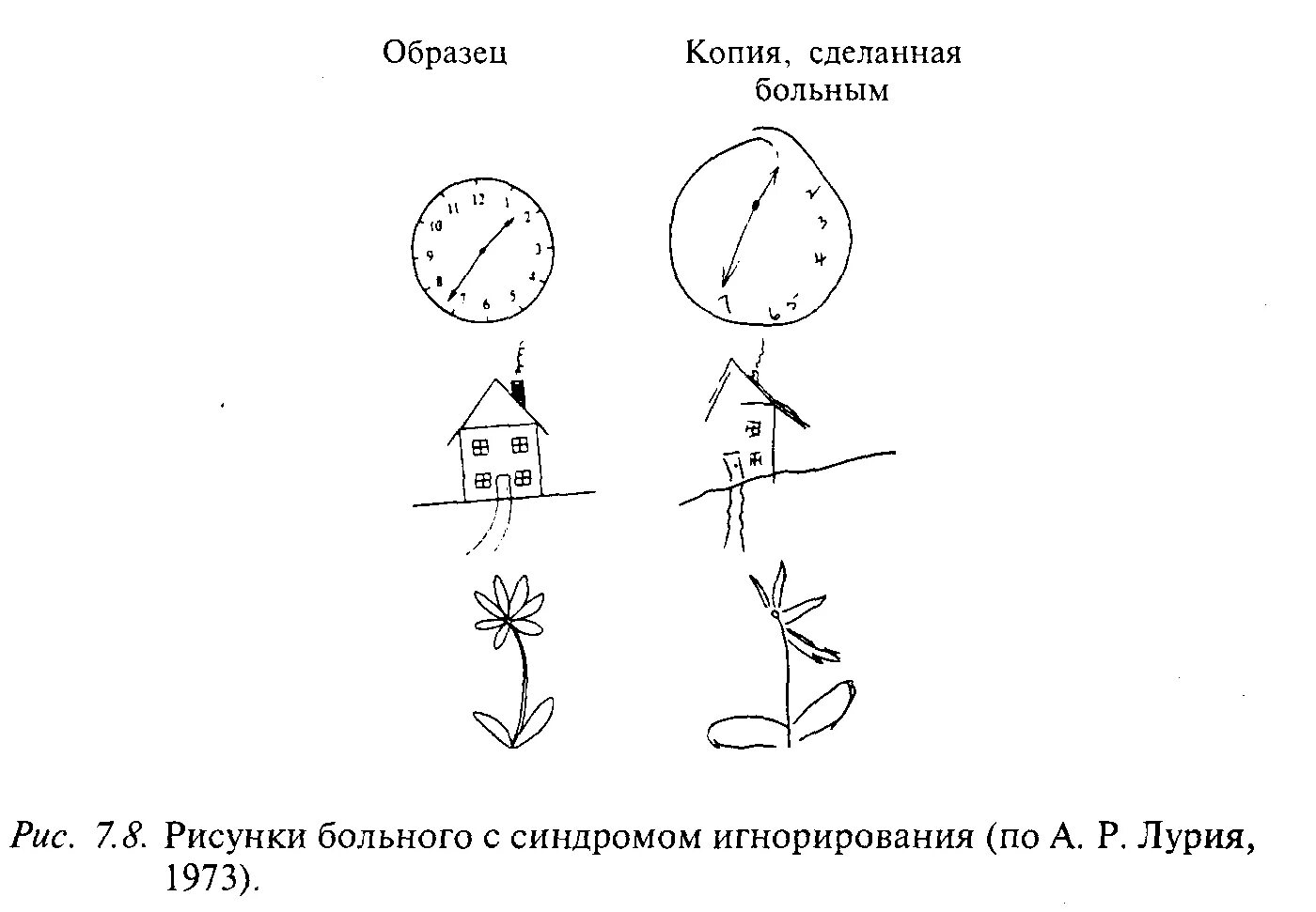 Нарушения оптико пространственных нарушений. Оптико-пространственная агнозия. односторонняя оптико-пространственная агнозия. односторонняя зрительно-пространственная агнозия. оптико-пространственная агнозия рисование.