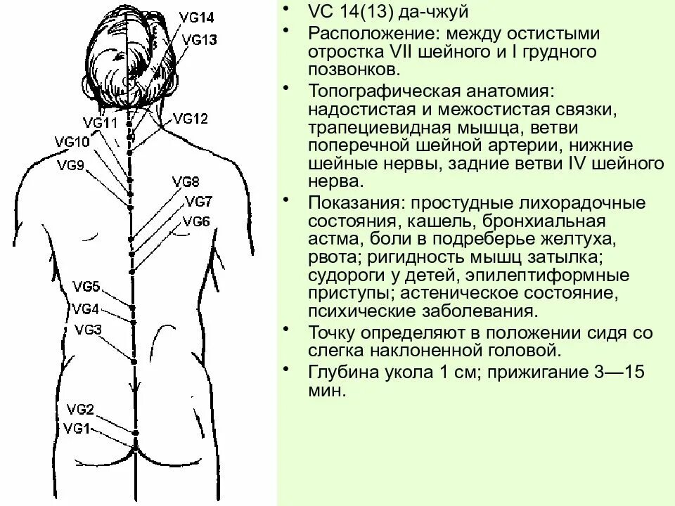 Артховикс меридиан