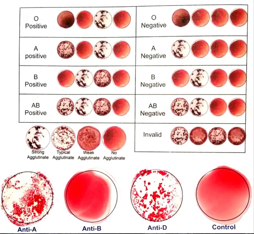 What Blood Tests Determine Heart Failure - Release Date Price Reviews