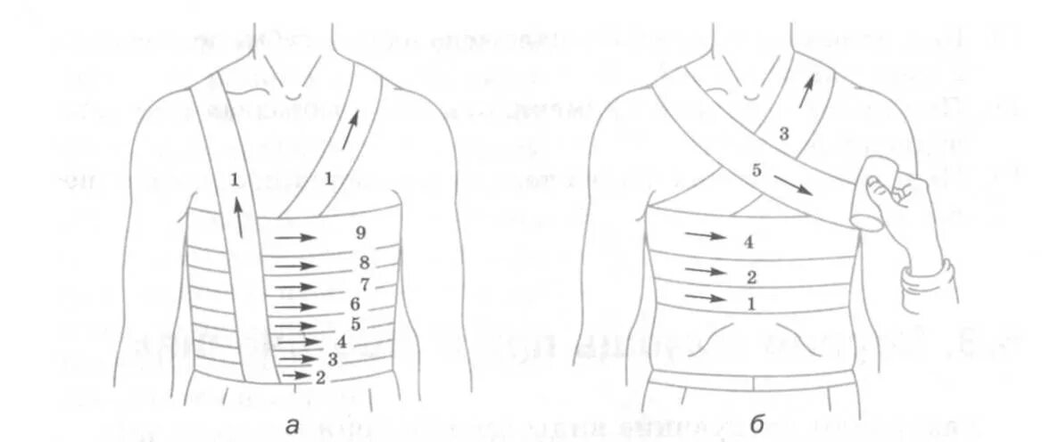 Техника наложения повязок на грудную клетку. Перелом ребра перевязка. Перевязка грудной клетки бинтом. Наложение циркулярной повязки на грудную клетку.