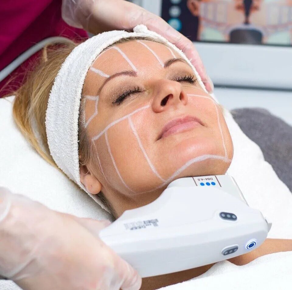 Альтера-терапия до и после. Altera фирма. Центр научной красоты альбины самойловой орел. Ультразвуковой smas-лифтинг альтера/ulthera. Шоссе энтузиастов 30 альтермедика.