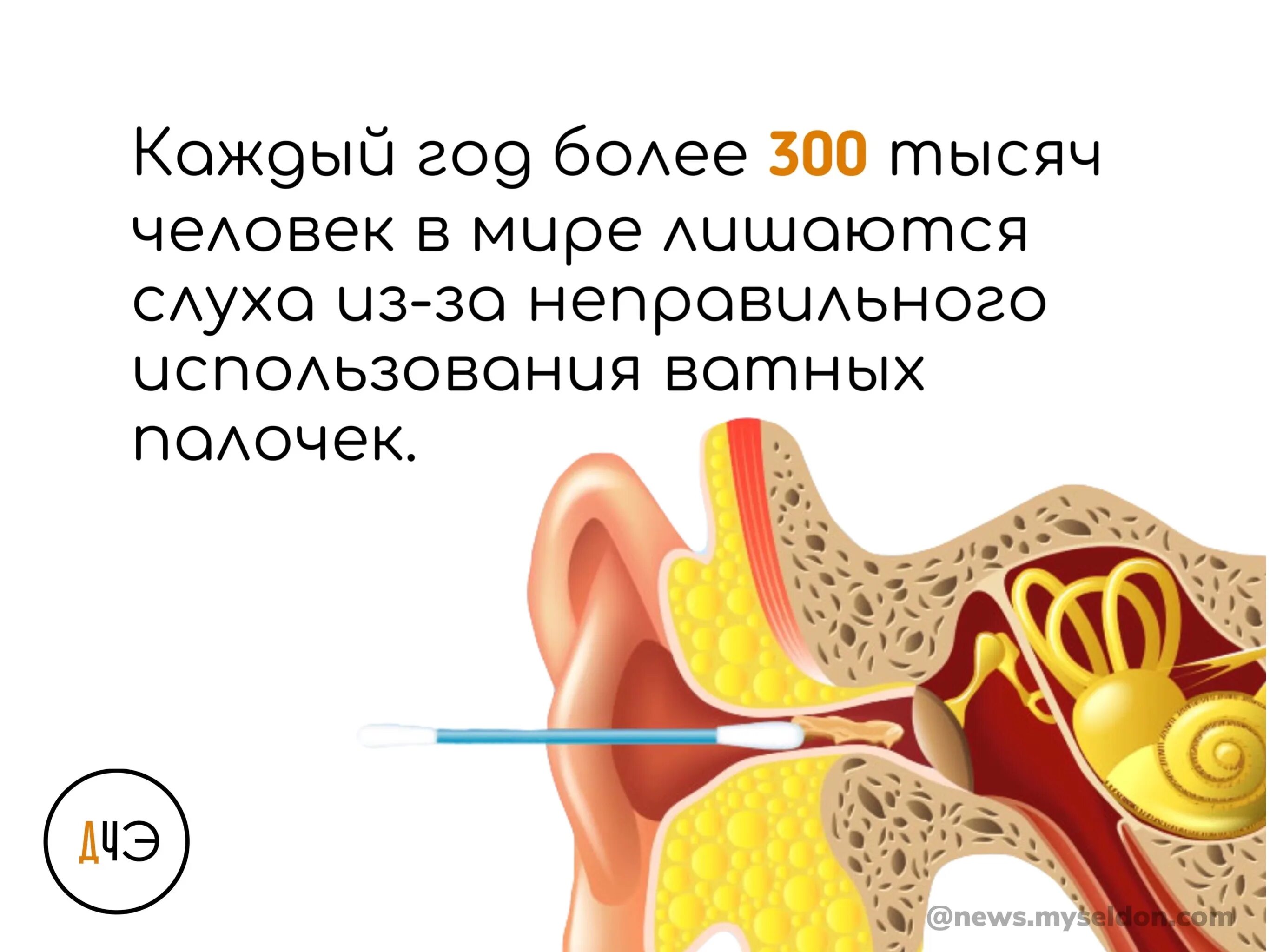 Профессиональная чистка ушей. Как правильно чистить уши палочкой. Аппаратная чистка ушей. Проткнул барабанную перепонку. Чистка ушей спб