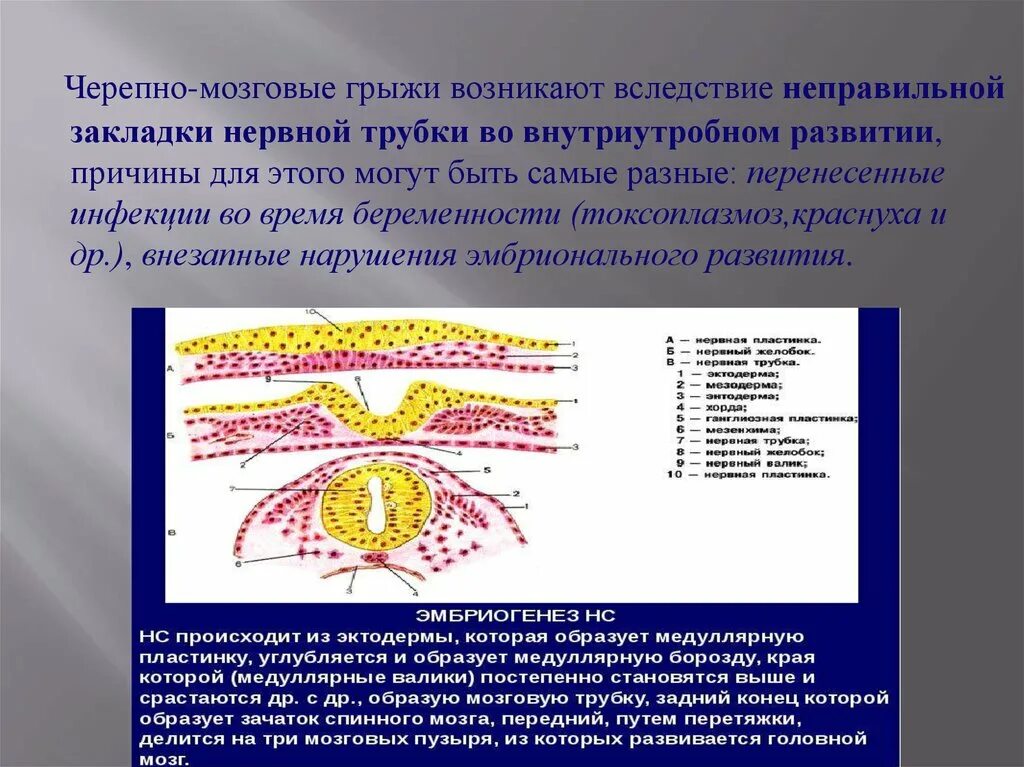 Грыжа мозговых оболочек освобождение нерва. Орбитальная мозговая грыжа. Черепно-мозговые грыжи грыжи. Серепномлзговые шрыжи. Черепно мозговые грыжи у детей.