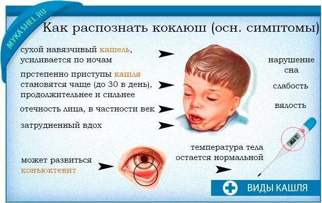 Сколько дней сухой кашель. Коклюш симптомы клинические проявления. Характерные клинические проявления коклюша. Характерный симптом коклюша. Детские инфекционные заболевания коклюш.