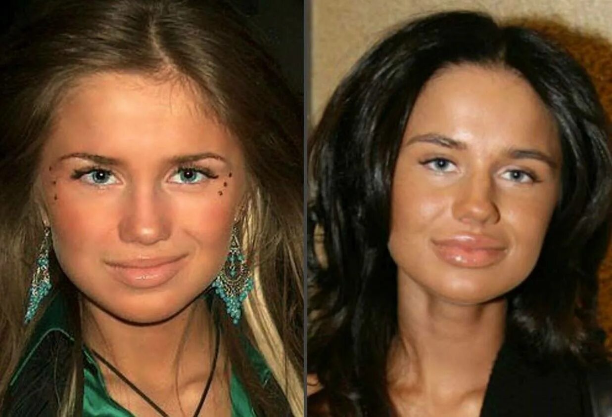 как называются пластические операции