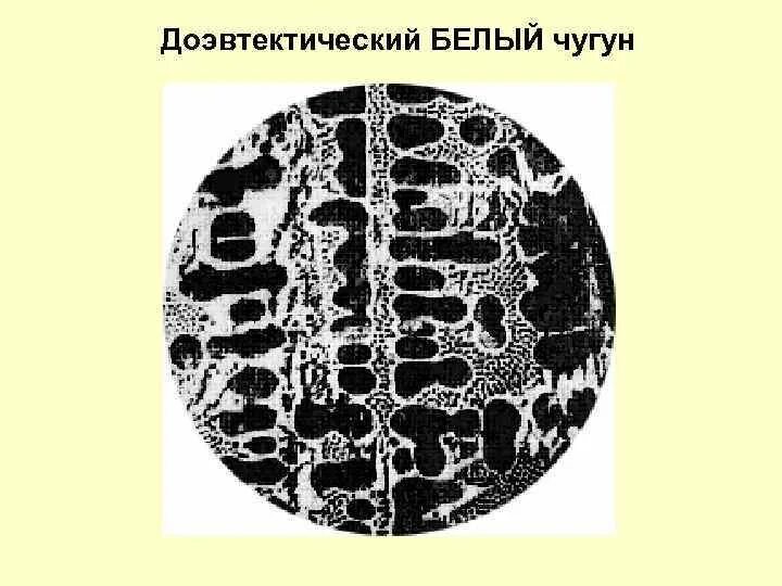 Какой чугун изображен на рисунке. Структура доэвтектического чугуна. Доэвтектический белый чугун структура. Структура доэвтектических Чугунов. Структура доэвтектического белого чугуна.