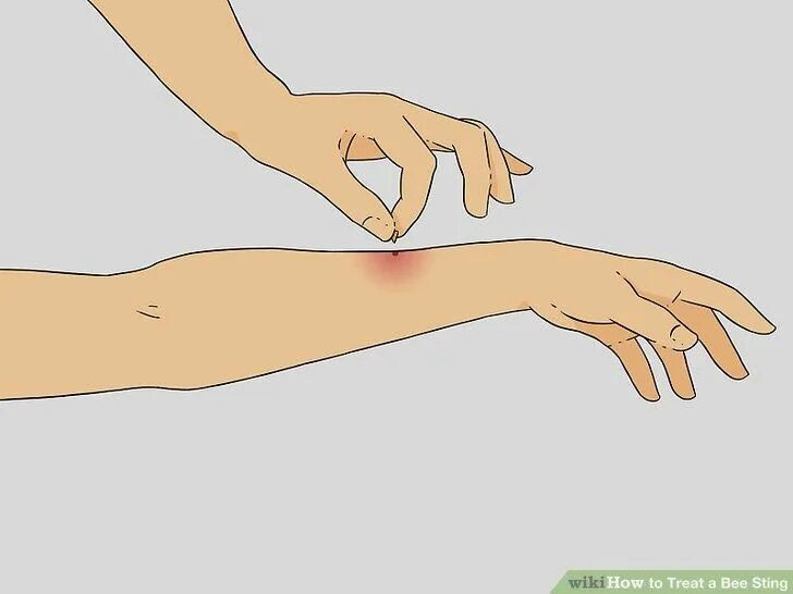Как выглядит укус грызуна Pin on Next tat maybe