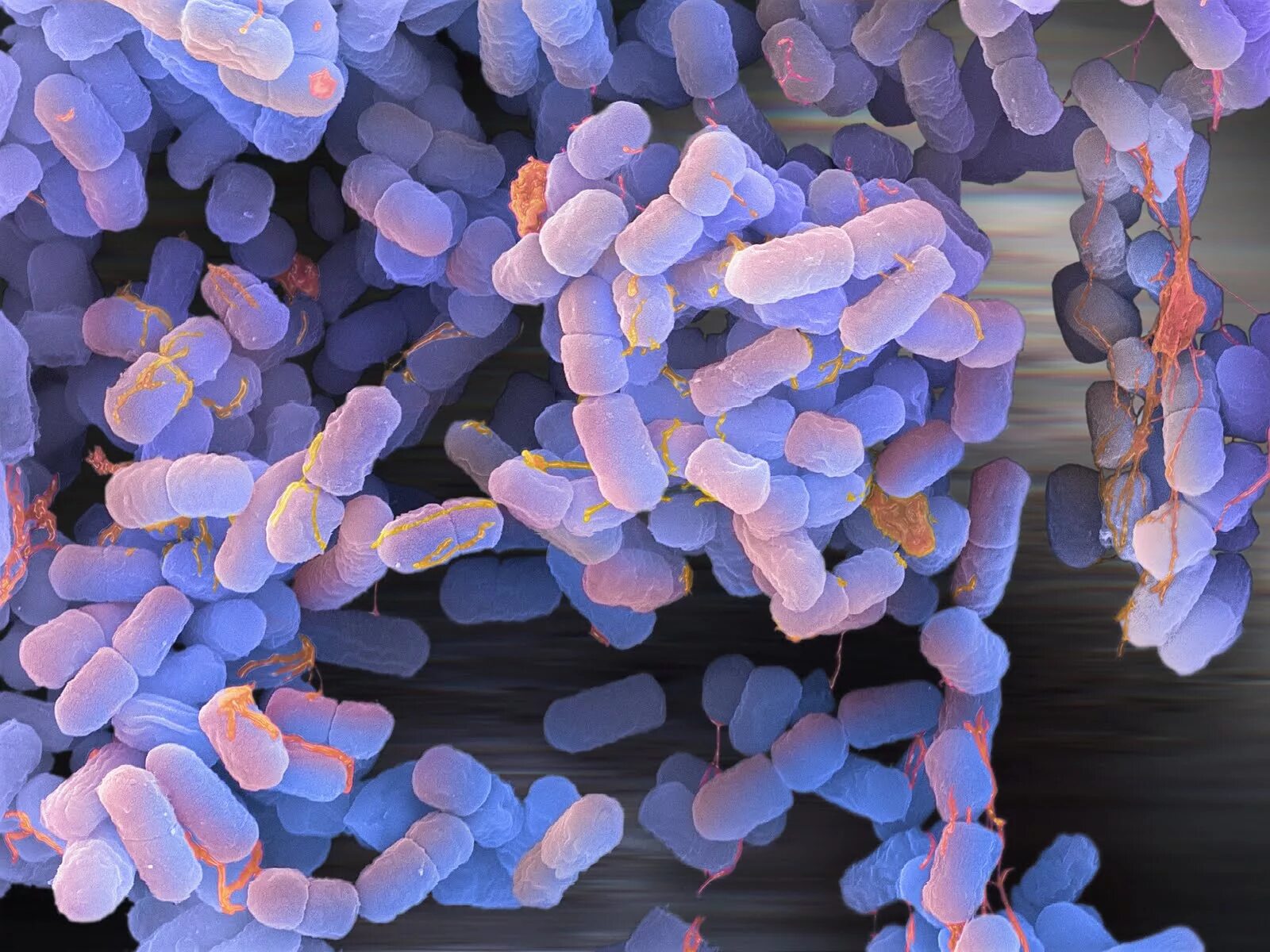 Coli sotwe. Клостридии микробиология. Клостридии под микроскопом. Бактерия Escherichia coli. Штамм бактерий Escherichia coli.