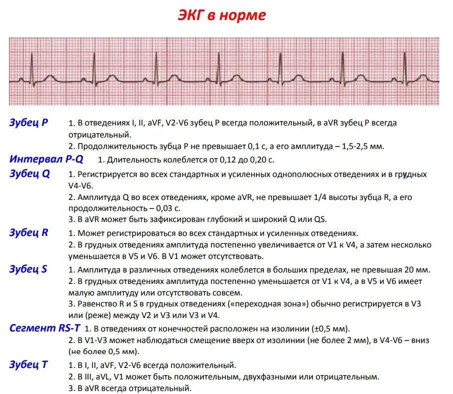 ЭКГ 1 отведение норма. Нормы зубцов ЭКГ. Зубец r на ЭКГ В норме. Норма ЭКГ во всех отведениях. Зубцы экг в норме