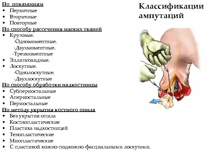 Классификация ампутаций конечностей. Классификация ампутаций по способу обработки надкостницы. Классификация ампутаций по способу рассечения мягких тканей. Показания к ампутации конечности.