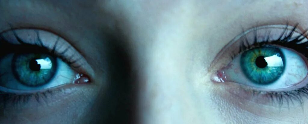 Whose eyes are these. Центральная гетерохромия у человека. Секторная гетерохромия глаза. Один глаз зеленый другой голубой. Гетерохромия зеленый и голубой глаза.