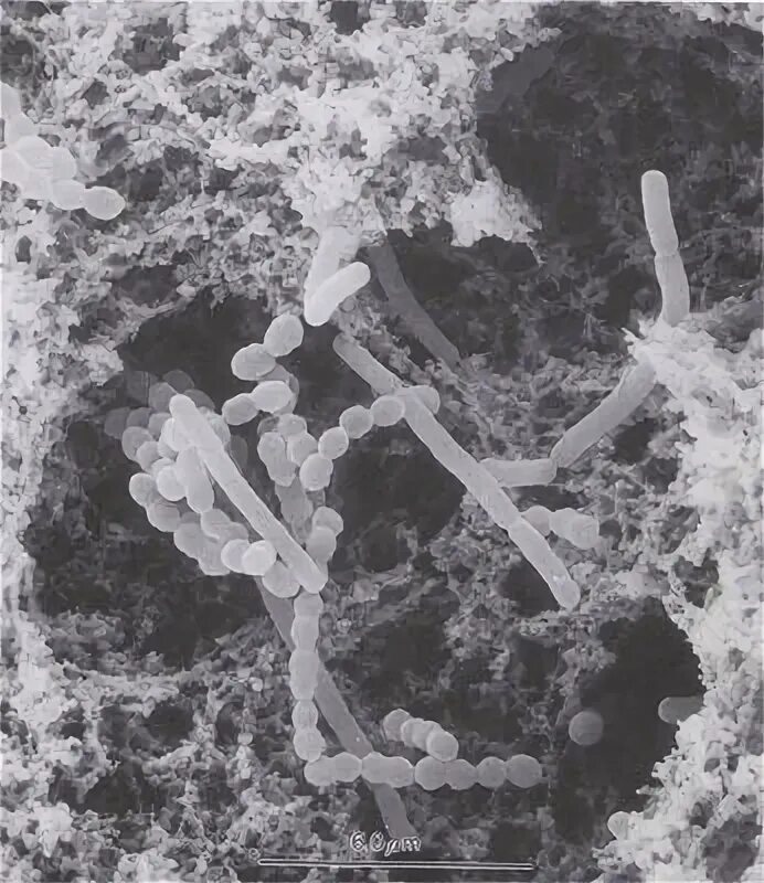 Молочнокислый стрептококк (streptococcus lactis). Термофильный стрептококк. Болгарская палочка lactobacillus bulgaricus. Болгарской палочки термофильного стрептококка. Термофильный стрептококк.