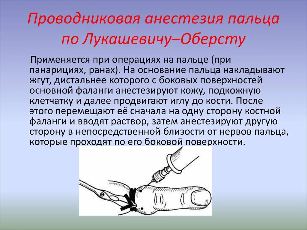 Анестезия на латинском. Проводниковая блокада по Лукашевичу Оберсту. Проводниковая анестезия по Лукашевичу Оберст. Местная анестезия по Оберсту-Лукашевичу. Проводниковая анестезия Оберст Лукашевич.