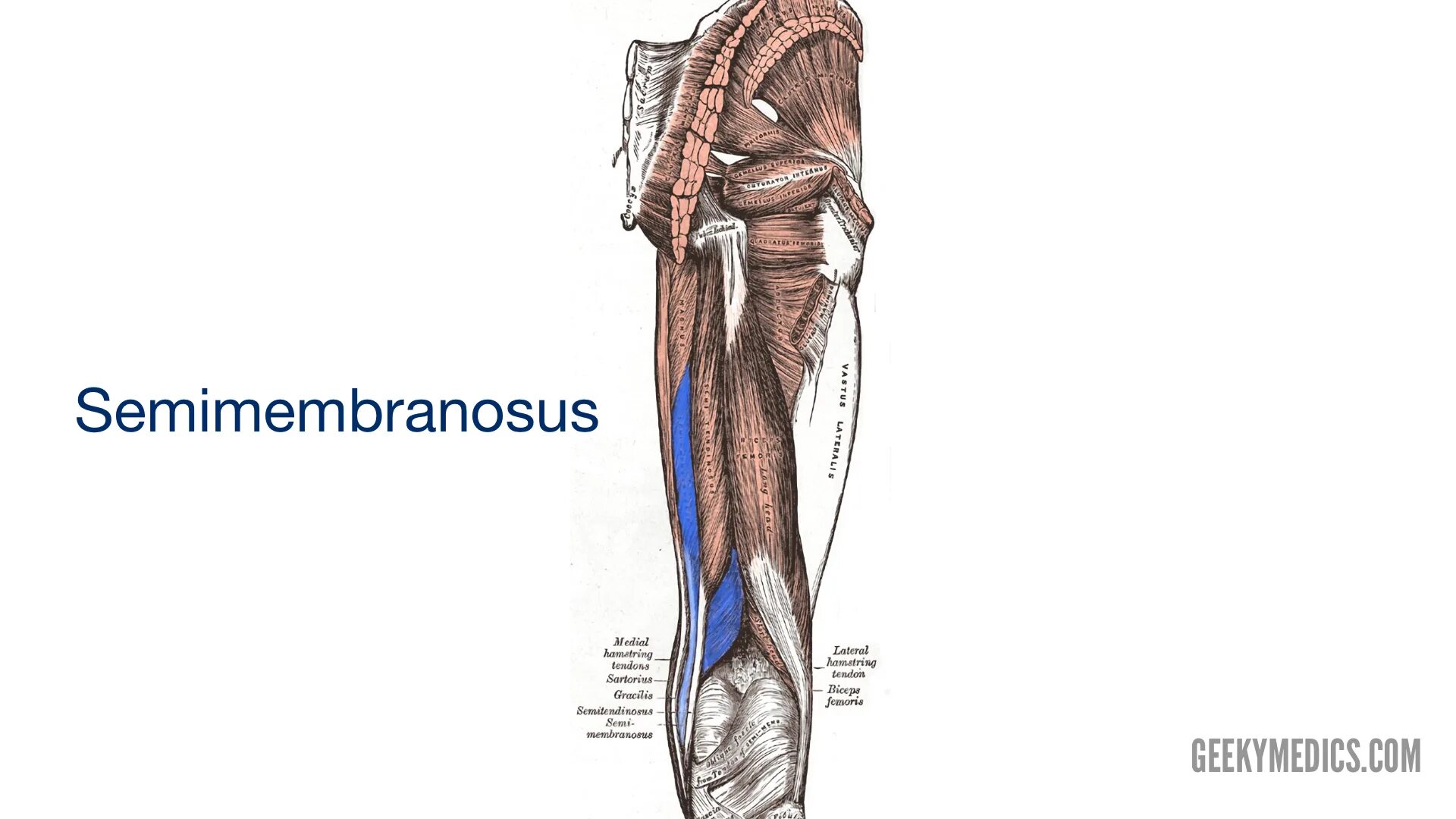 Место прикрепления полуперепончатой мышцы. Semimembranosus. M semimembranosus место нахождения. Musculus semimembranosus. М semimembranosus получает иннервацию от.