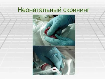 Неонатальный скрининг это