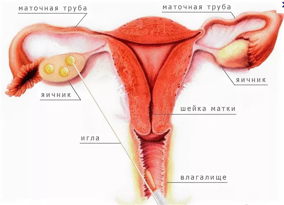 Где матка и яичники. Яичник маточная труба и матка. Придатки и яичники одно и тоже. Придатки и яичники это одно и то же.