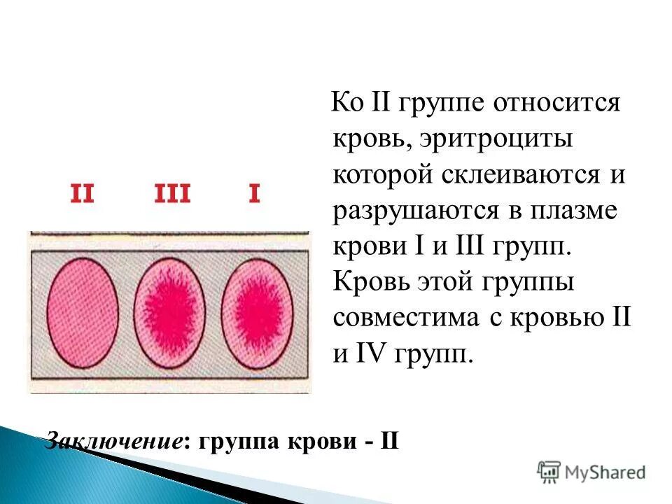 Группа крови клетки. Группы крови эритроциты. 3 Группа крови. 4 Группа крови эритроцит. К какому типу ткани относится кровь?.