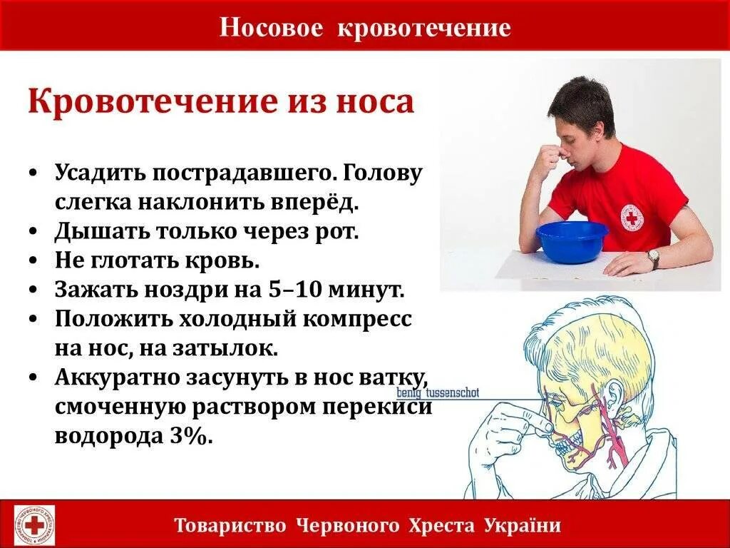 Идёт кровь из носа причины. Нлсовоеткровоьечение у детей. Сильно течет из носа что делать