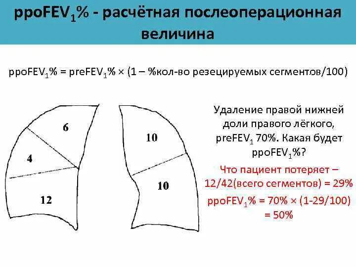 Правое легкое сколько долей. Сегменты нижней доли левого легкого. Легкое правое схеме состоит.