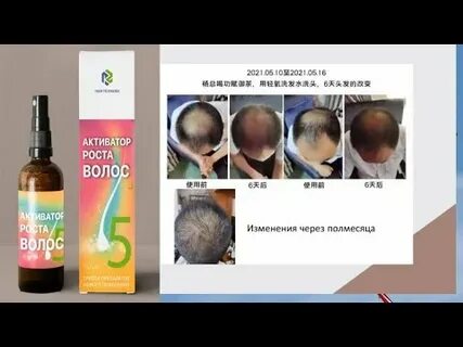 Для усиленного роста волос на голове